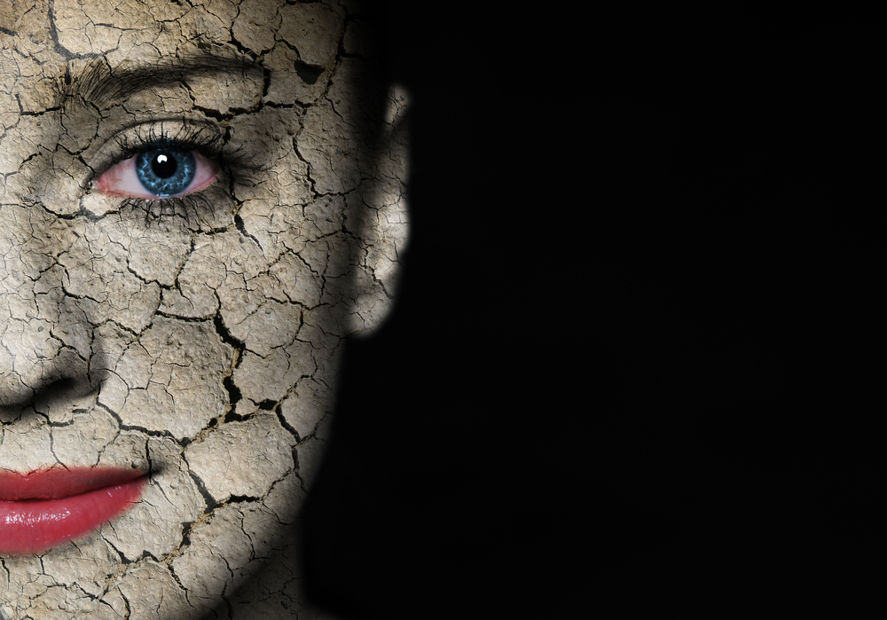 אישה עם פנים יבשות ועין כחולה