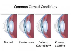 Common Cornel Conditions