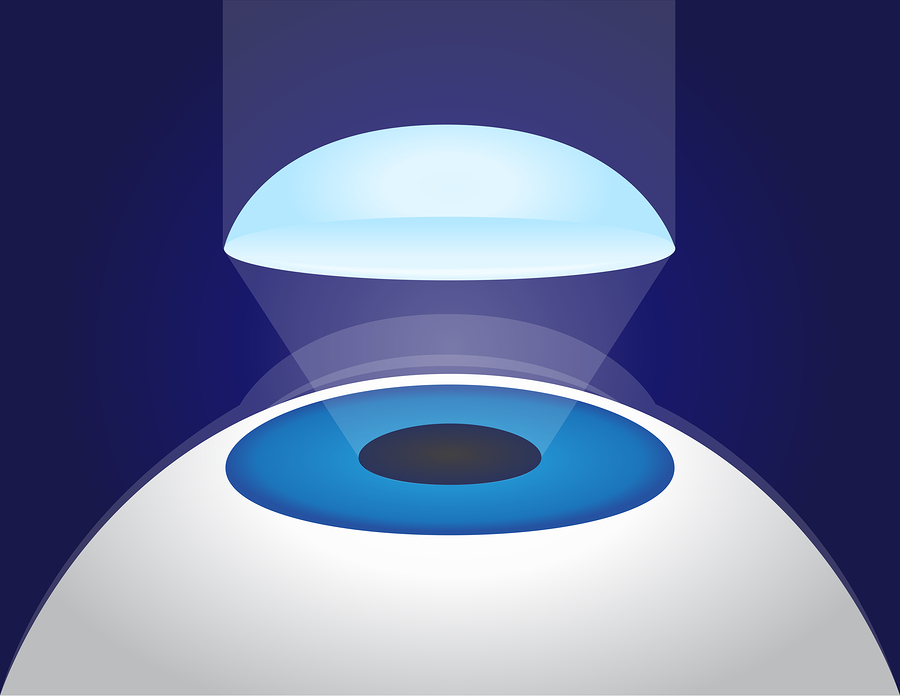 תסמונת סטיבן ג'ונסון